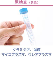 尿検査(男性)クラミジア、淋菌