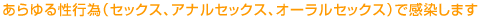 �����鐫�s�ׁi�Z�b�N�X�A�A�i���Z�b�N�X�A�I�[�����Z�b�N�X�j�Ŋ������܂��@�@