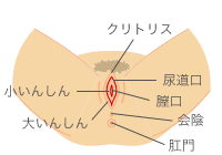 フォアダイスの症状