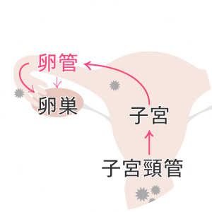 なんでクラミジアで不妊症に?