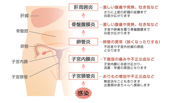 クラミジア 原因 ストレス