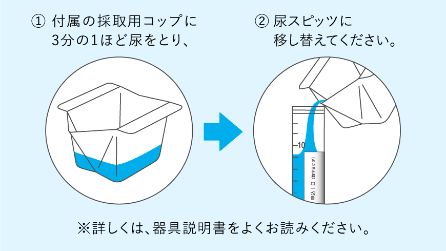 採尿の方法