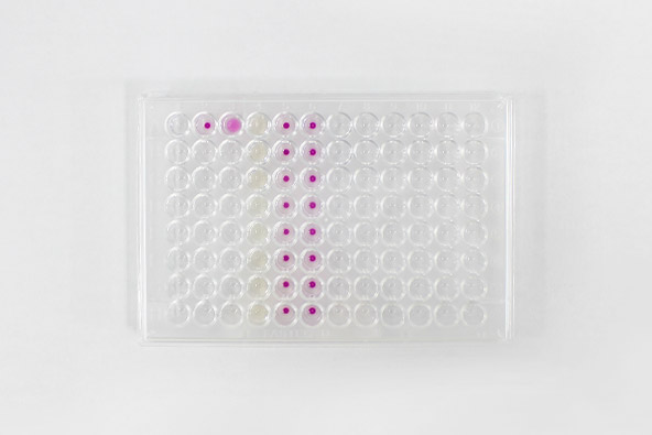 AIDSを知る AIDS用迅速検査キット - DETERMINE™ - Abbott - 感染病用 / 抗原