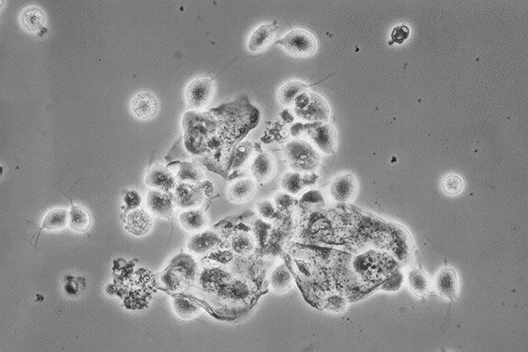 トリコモナス原虫