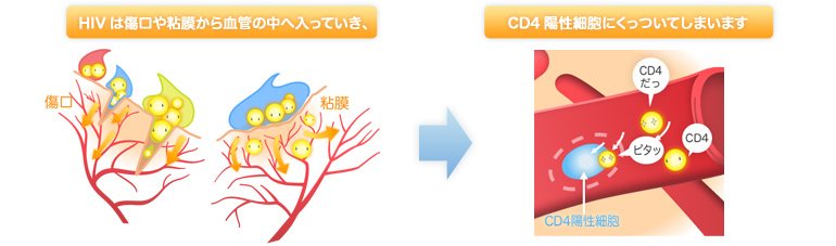 HIVは傷口や粘膜から血管の中へ入っていき、CD4陽性細胞にくっついてしまいます