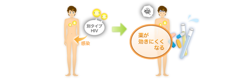 別タイプHIV 感染 薬が効きにくくなる