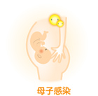 母子感染