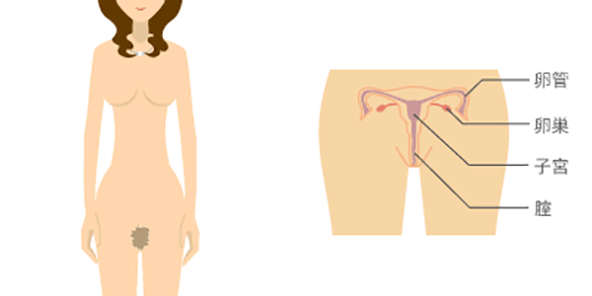 クラミジアの発症箇所（女性）