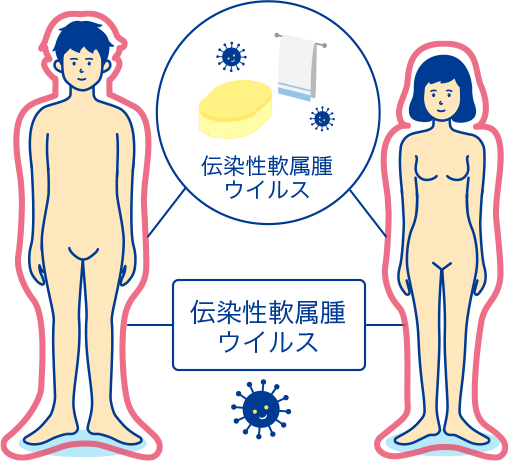 小学生　恥丘 性器伝染性軟属腫（ミズイボ）の解説 症状や感染経路・検査や治療について│STD研究所