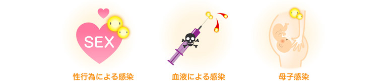Hiv感染症 エイズの解説 症状や感染経路 検査や治療について Std研究所 Hiv感染症 エイズの解説 症状や感染経路 検査や治療について Std研究所