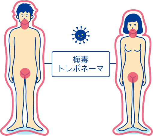 梅毒の解説 症状や感染経路 検査や治療について Std研究所 梅毒の解説 症状や感染経路 検査や治療について Std研究所